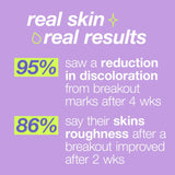 Dermalogica Post Break Out Fix 15ml